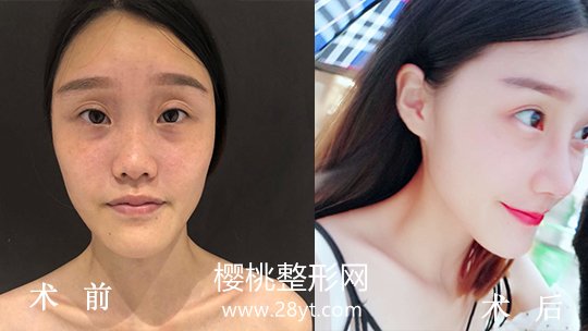 福州爱美尔医疗美容门诊部正规吗？做整形价格贵不贵？