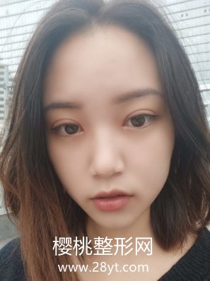 上海第九整形美容医院价格表曝光+双眼皮前后案例分享