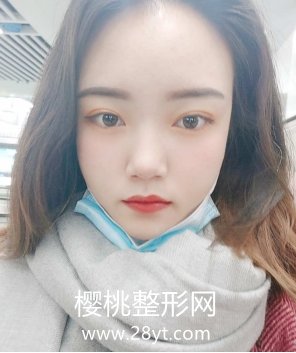 上海第九整形美容医院价格表曝光+双眼皮前后案例分享