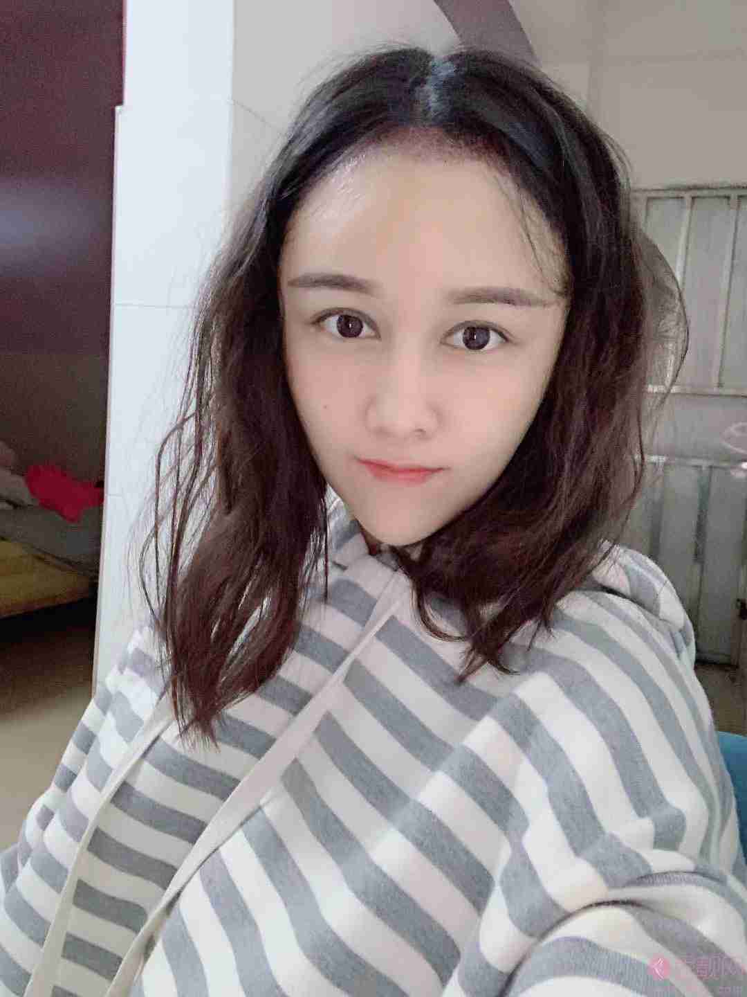 碧莲盛和雍禾哪个技术好?价格表曝光+真实案例果对比