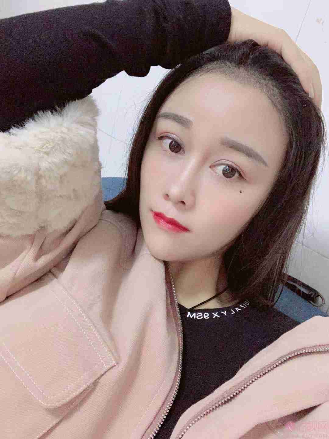 碧莲盛和雍禾哪个技术好?价格表曝光+真实案例果对比