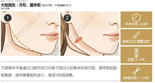 八大处和九院削骨哪个好?国内高人气整形医院、科室实力对比!附案例反馈