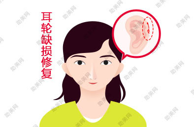 耳轮缺损修复