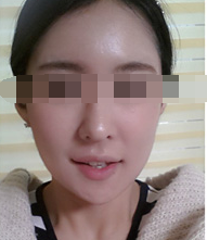 术后图片 术后图片
