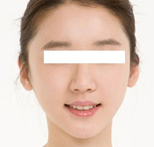 术后图片 术后图片