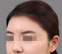 术后图片 术后图片