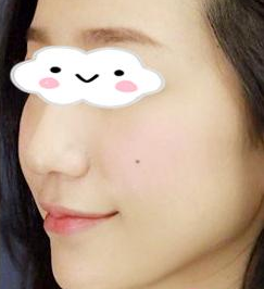 术后图片 术后图片