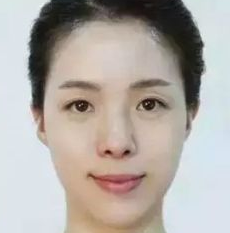 术后图片 术后图片