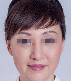 术后图片 术后图片