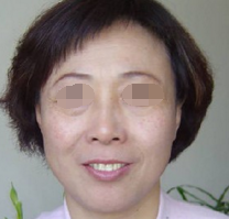 术前图片 术前图片