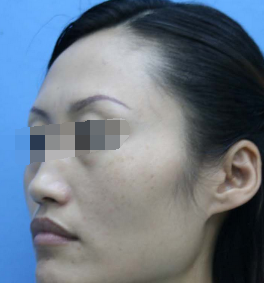 术后图片 术后图片