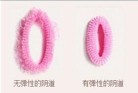 术后图片 术后图片