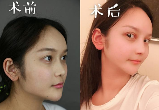 四川华美紫馨磨骨怎么样,价格表曝光