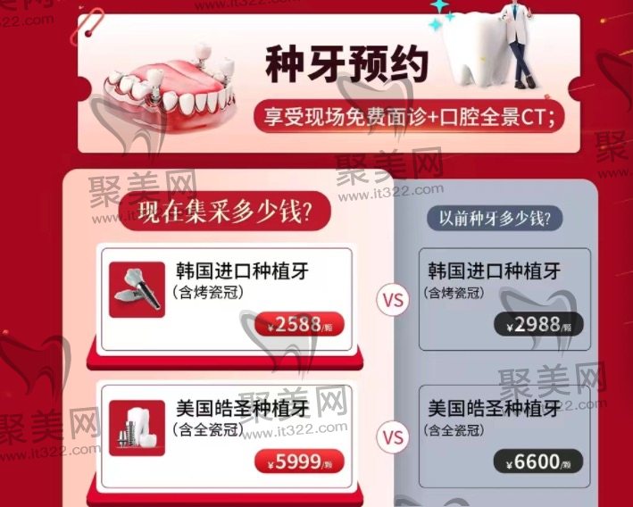 上海金高口腔种植牙集采价格