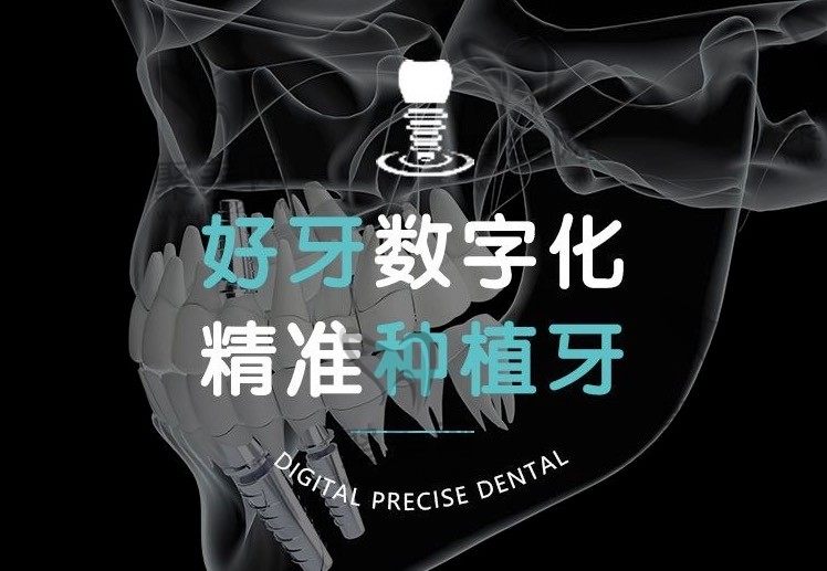 北京好牙口腔连锁4月份优惠活动来袭,奥齿泰种植牙价格仅2980元起！