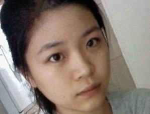 隆鼻+开眼角+韩式微切双眼皮,让我距离完美更近