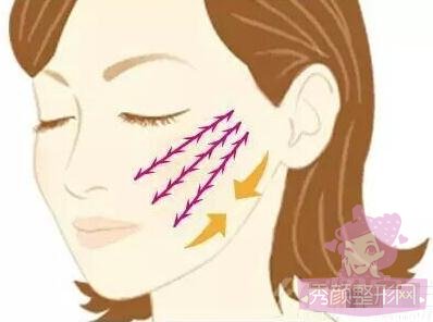 热玛吉,超声提拉,4D埋线提升哪个果好?