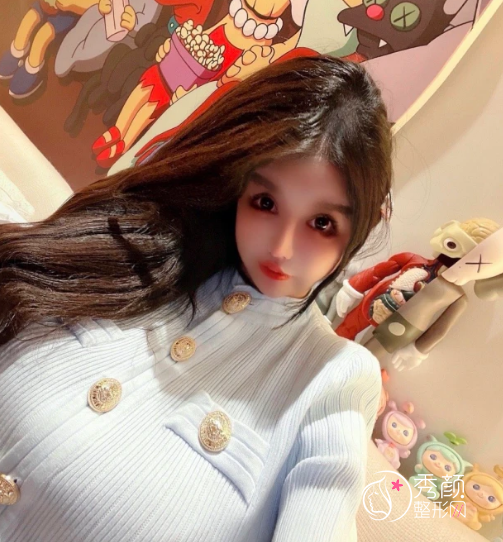 女网红全脸整容,花费400万整容失败却不自知,怒怼黑粉