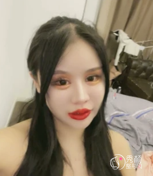 女网红全脸整容,花费400万整容失败却不自知,怒怼黑粉