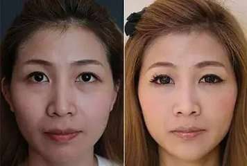 美容绣眉想做个普通的预算多少？