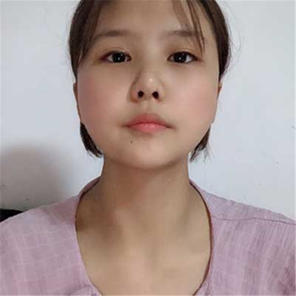 上海华美李健抽脂术后果怎么样?案例_价格