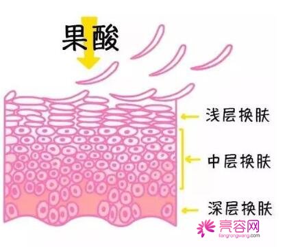 微创面部提升果如何？内附微创面部提升真实果分享，告别苍老脸庞