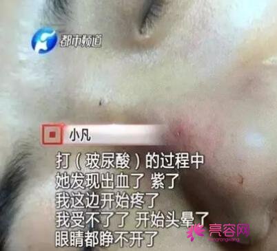 西京医院肖博医生做双眼皮怎么样？医生信息介绍+双眼皮案例