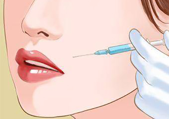 玻尿酸填鼻唇沟要多少用量？玻尿酸填鼻唇沟后怎么护理？