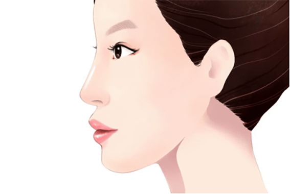 隆鼻的方法有哪些？自体软骨隆鼻有哪些优点？