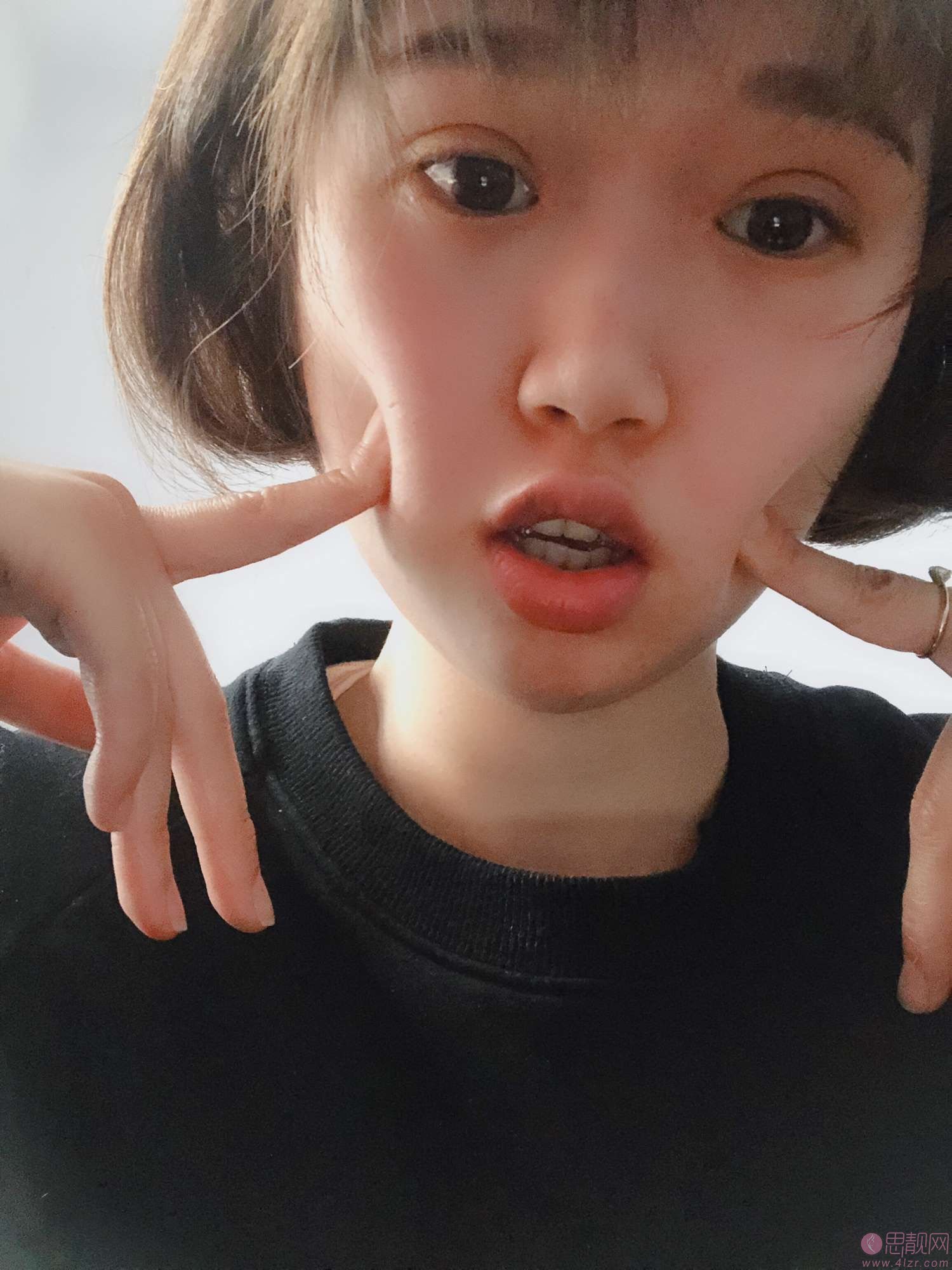 郑州孔宇眼整形怎么样?附双眼皮真人案例分享+2021年价格表发布