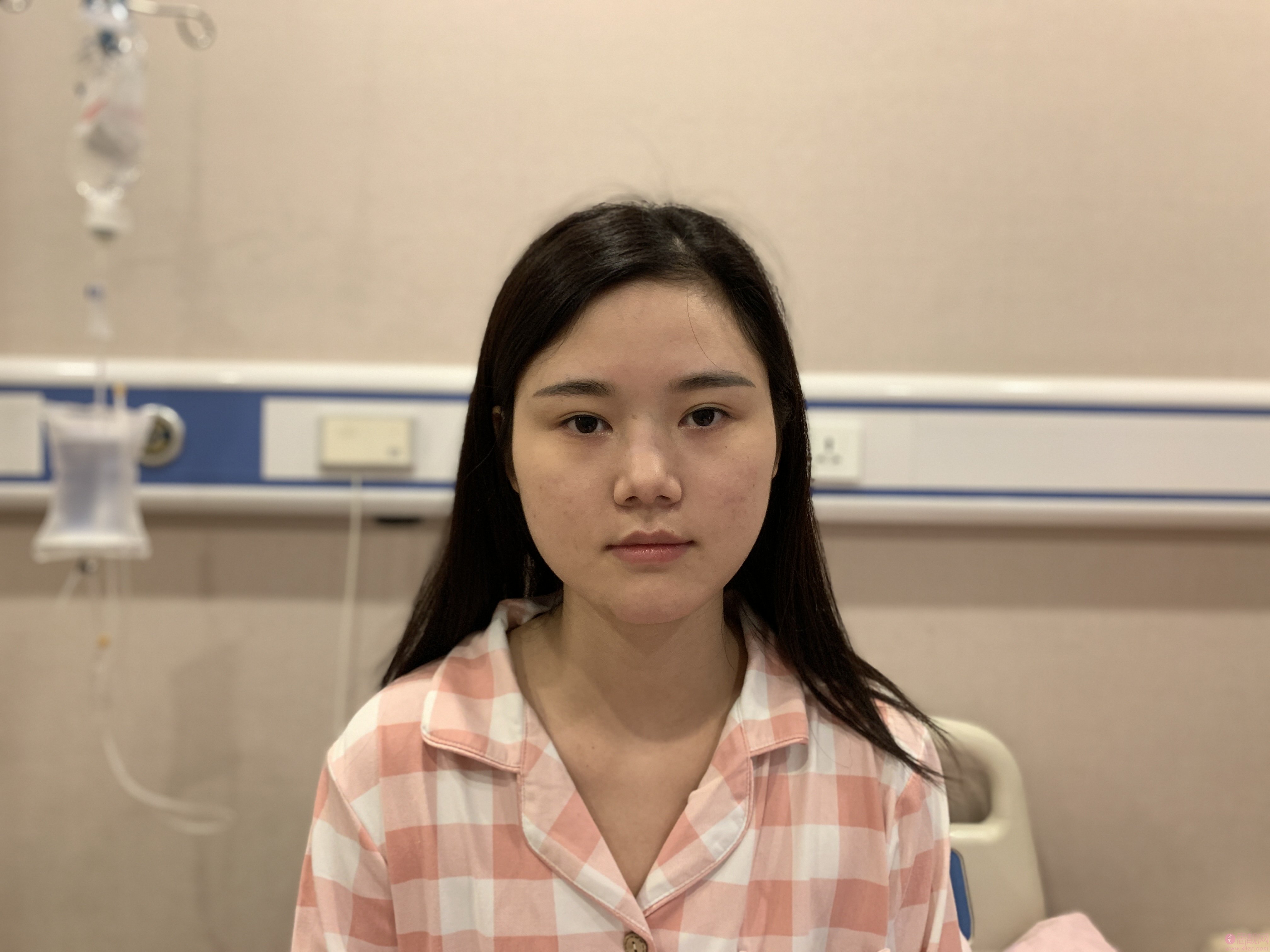 郑州蕾娜斯整形医院正规吗?附隆鼻案例+2021年价格表公开