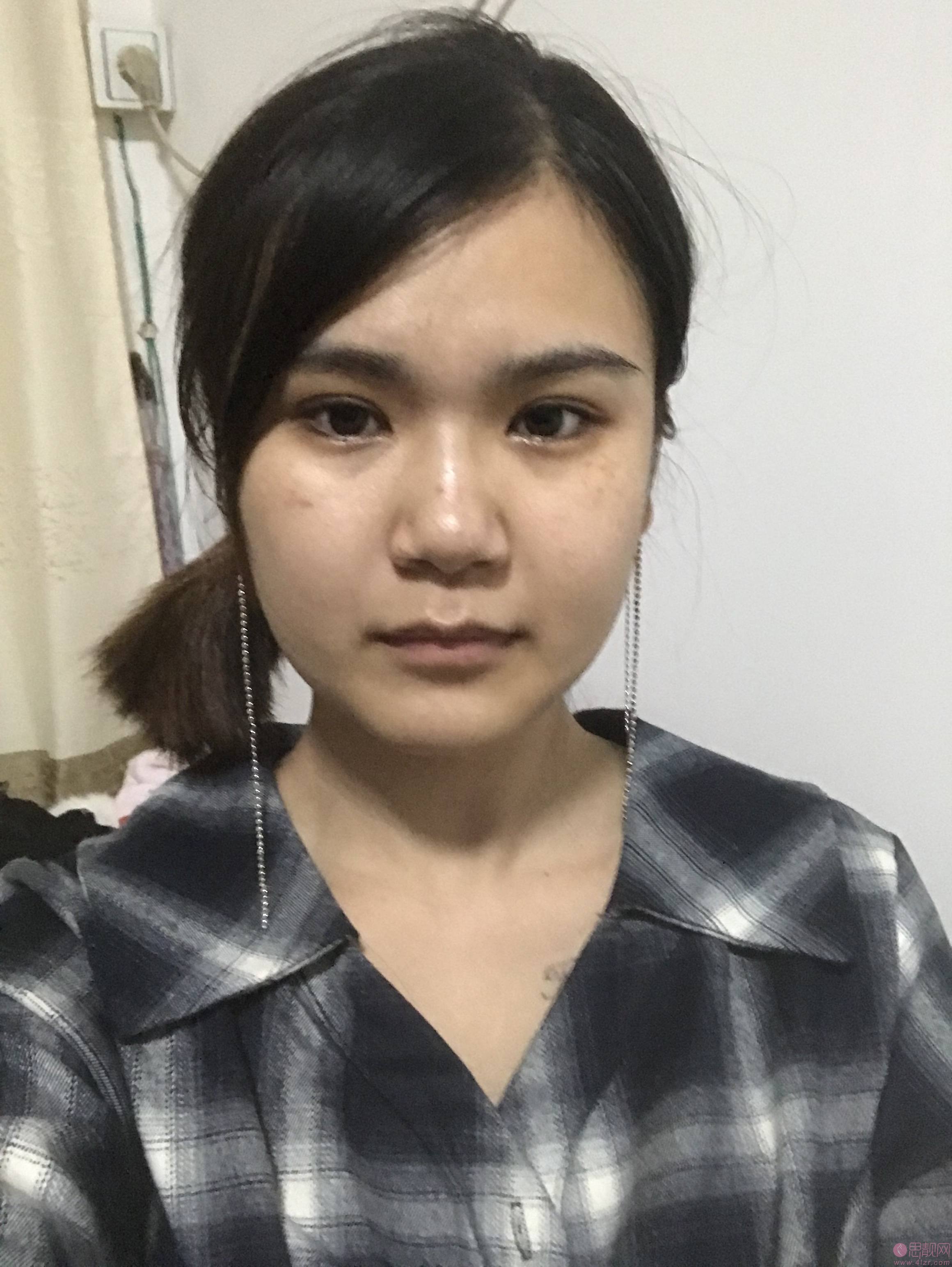 广州曙光美容医院祛斑怎么样?附祛斑前后效果对比及2021项目价格表发布