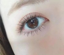 双眼皮整形手术会影响眼睛视力吗