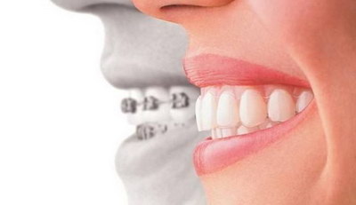40岁整形牙齿需要多长时间_杭州整形牙齿的最好的医院