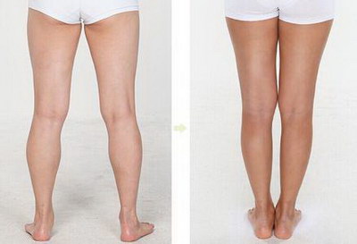 女生瘦腿容易吗