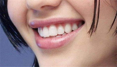 龅牙整形是什么原因造成的