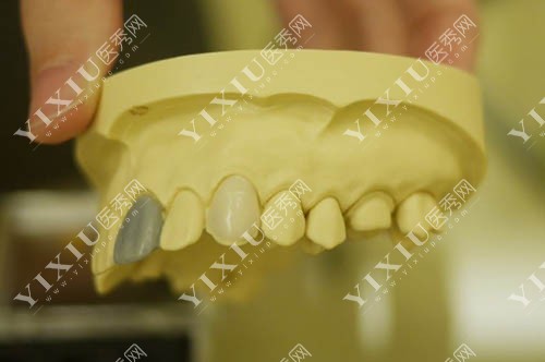 牙齿模型实拍图