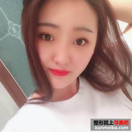 颜值不够,玻尿酸隆鼻来凑 颜值不够,玻尿酸隆鼻来凑