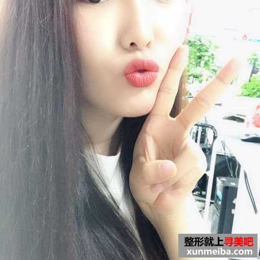 颜值不够,玻尿酸隆鼻来凑 颜值不够,玻尿酸隆鼻来凑