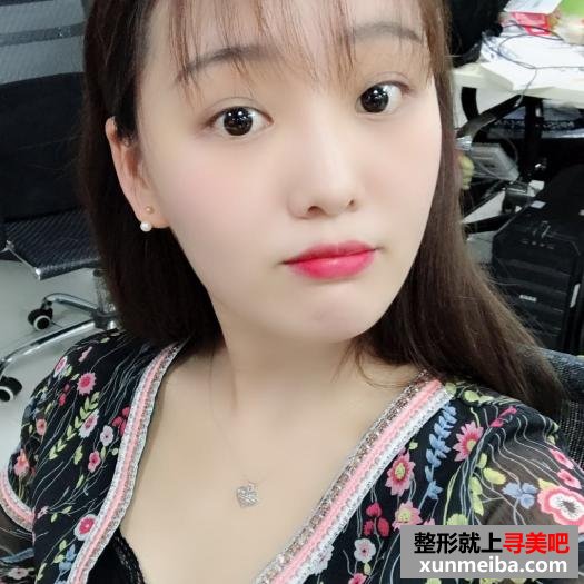 颜值不够,玻尿酸隆鼻来凑 颜值不够,玻尿酸隆鼻来凑