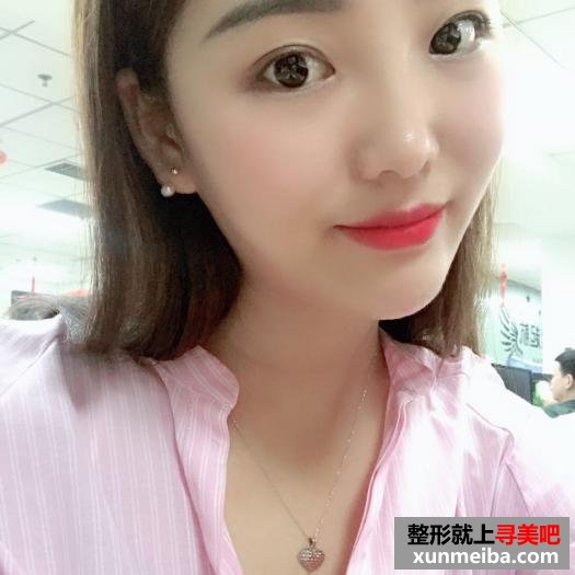 颜值不够,玻尿酸隆鼻来凑 颜值不够,玻尿酸隆鼻来凑