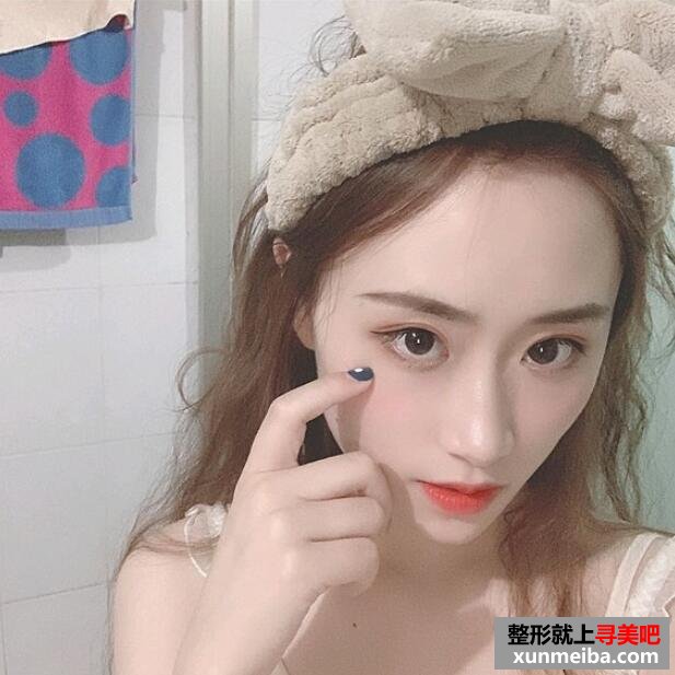 玻尿酸垫下巴 玻尿酸垫下巴